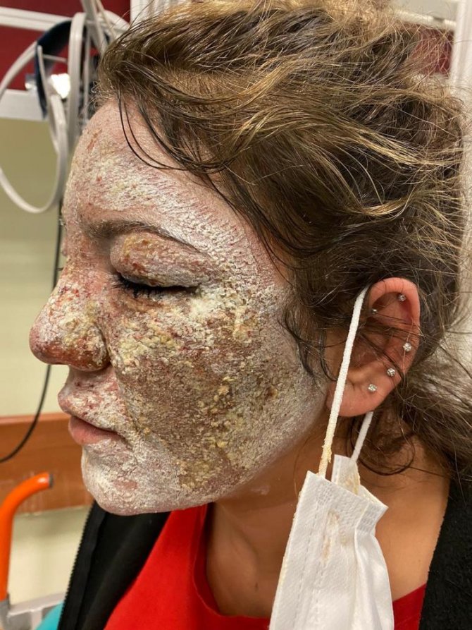 Güzellik merkezine gitti güzelliğinden oldu!