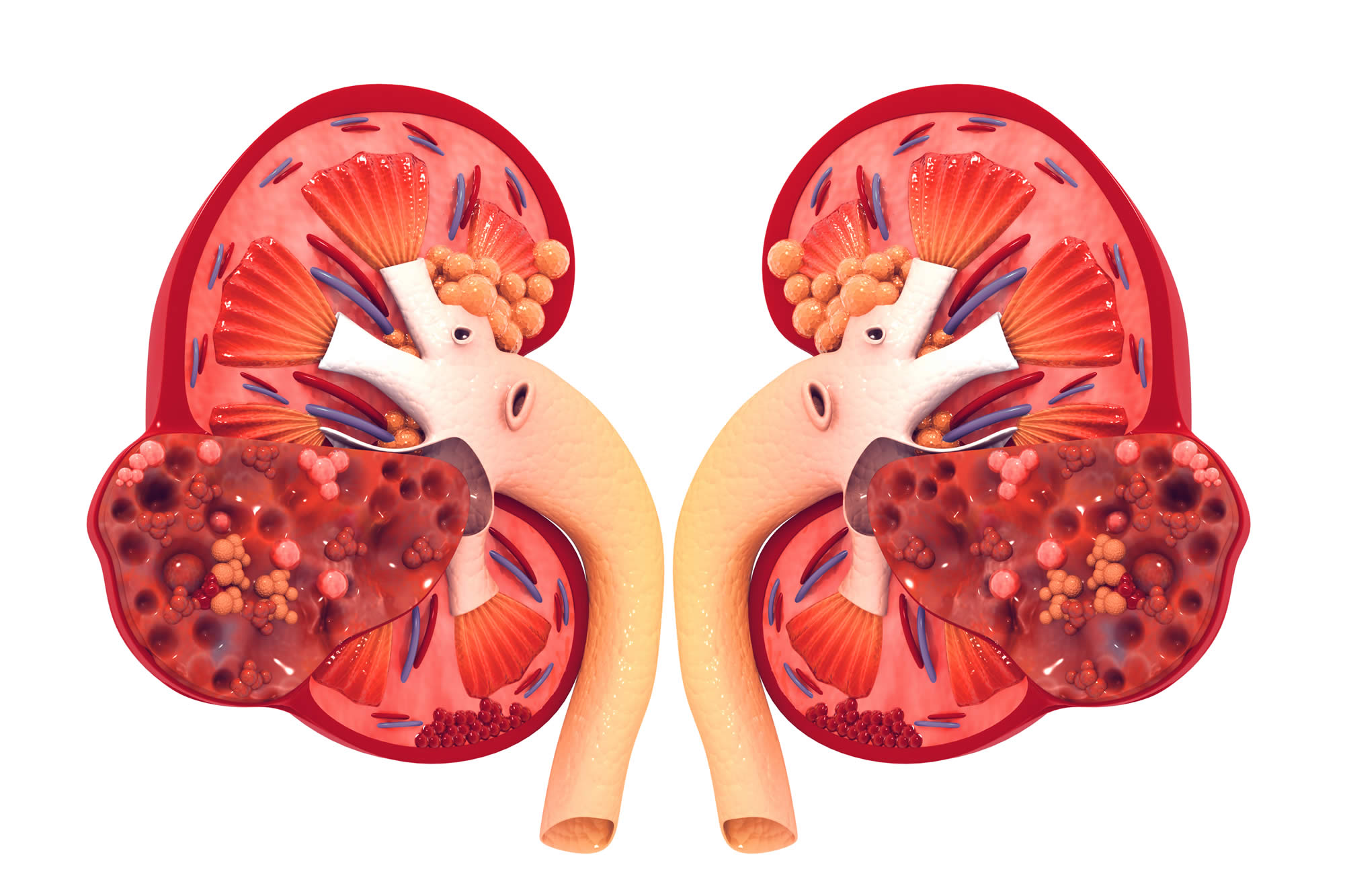 Pendik'te böbrek sağlığı ve şeker hastalıkları konularına değinildi!