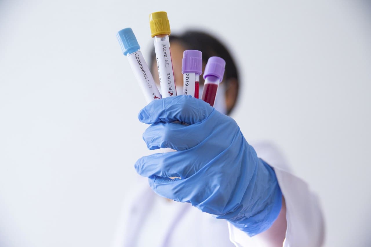 Koronavirüste yeni uyarı: Kangrene sebebp oluyor! Birçok hasta uzuvlarını kaybetti!