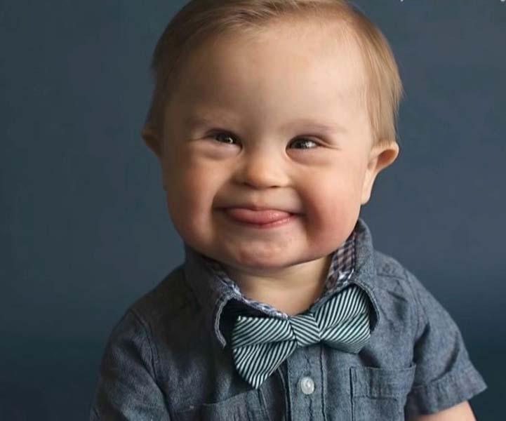 Down Sendromu Günü neden 21 Mart tarihinde kutlanıyor?