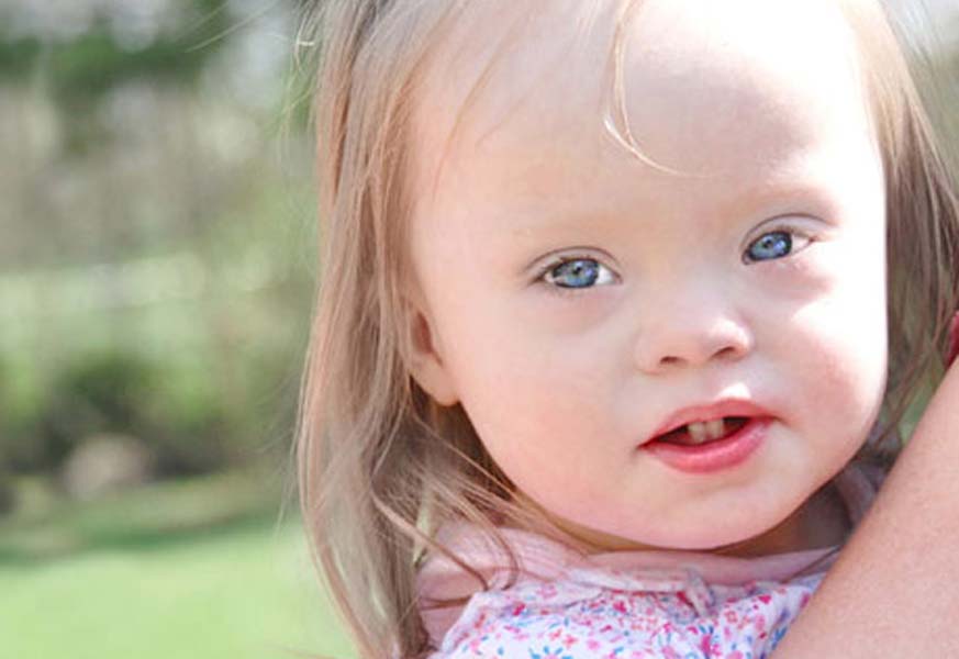 Down Sendromu Günü neden 21 Mart tarihinde kutlanıyor?