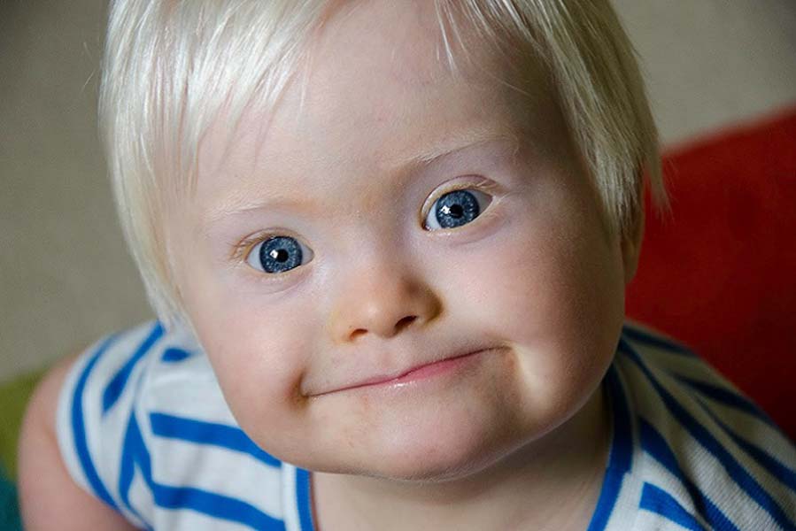 Down Sendromu Günü sözleri | Down Sendromu Günü mesajları