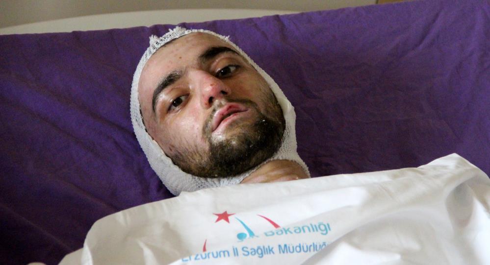 Banyo yapmak için sobaya benzin döken genç cayır cayır yandı!