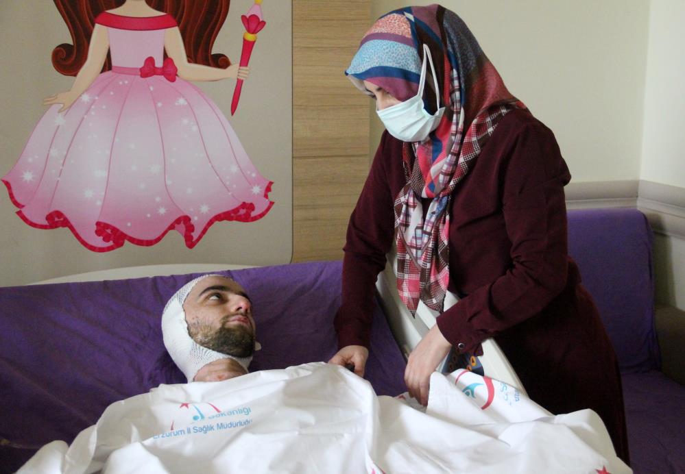 Banyo yapmak için sobaya benzin döken genç cayır cayır yandı!