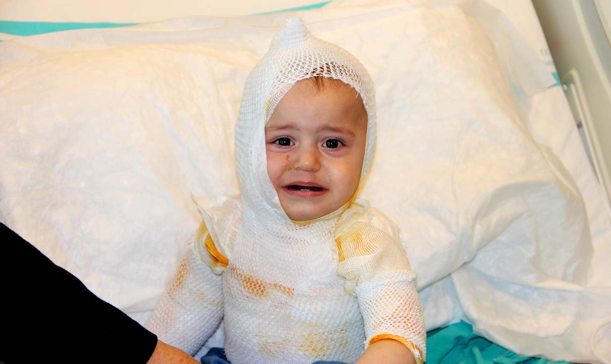 Bir anlık dalgınlık nelere mal oldu! Üzerine kaynar süt dökülen 1 yaşındaki çocuk feci şekilde yandı