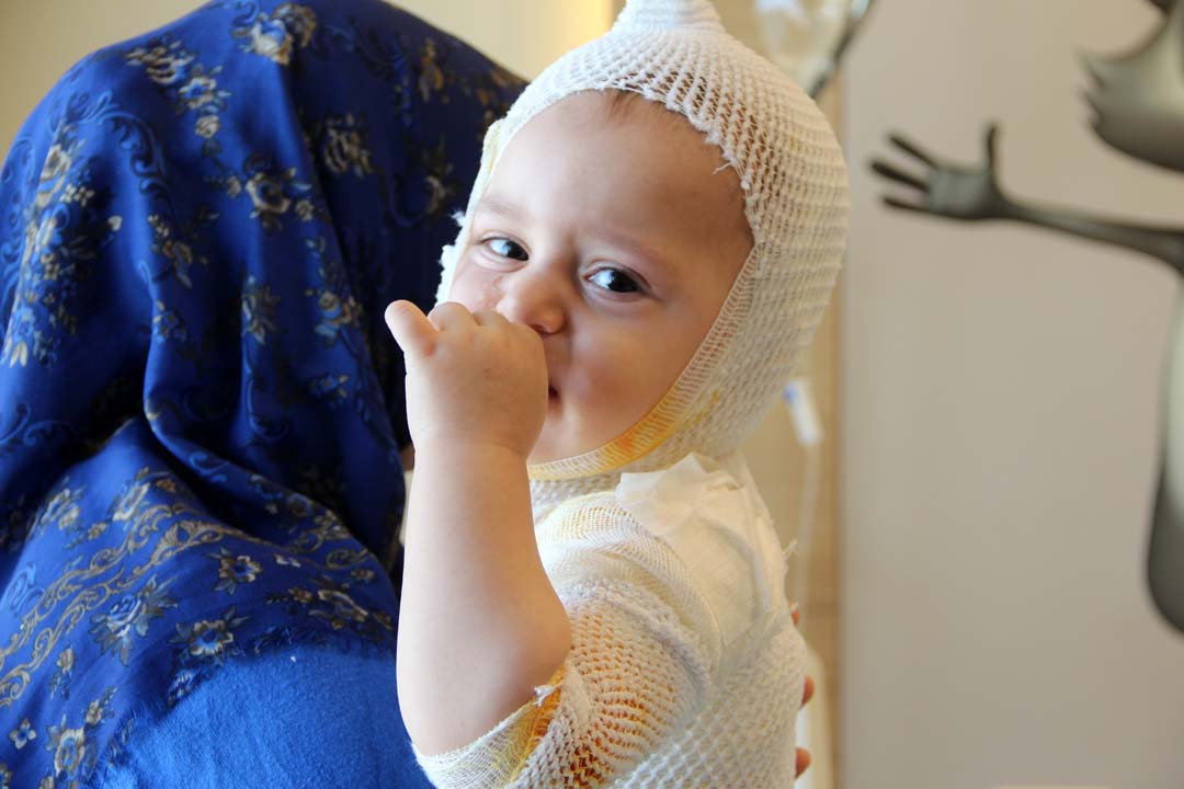 Bir anlık dalgınlık nelere mal oldu! Üzerine kaynar süt dökülen 1 yaşındaki çocuk feci şekilde yandı