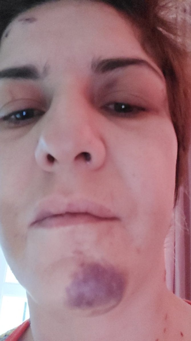 İzmir'de kadına şiddet! Dini nikahlı eşine kabusu yaşattı