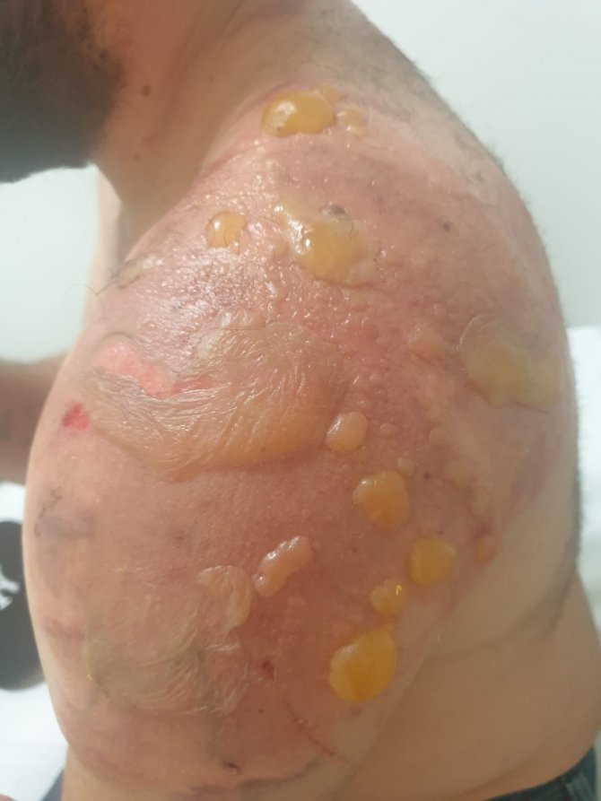 Boşanmadığı için kardeşleri eşini darp etti: Kadın kocasını savundu