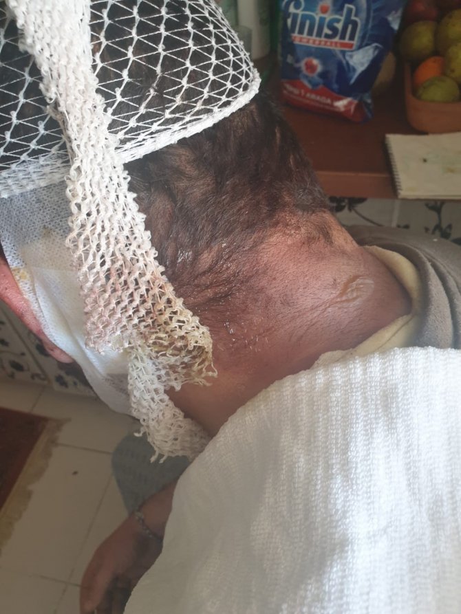 Boşanmadığı için kardeşleri eşini darp etti: Kadın kocasını savundu