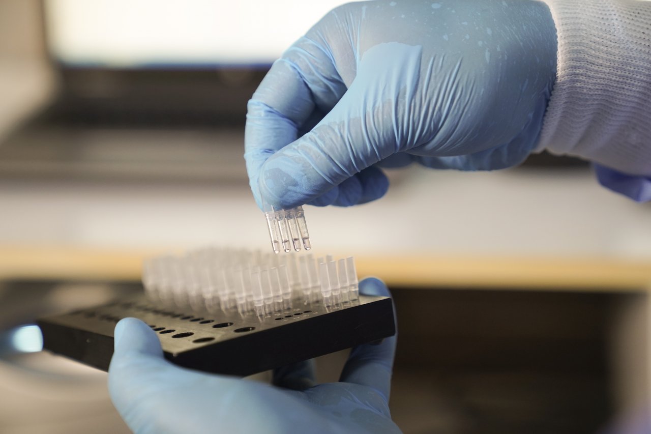 Mikrobiyologlar uyardı! Aşı sonrası antikor testlerinde güvenilirliğe dikkat edilmeli