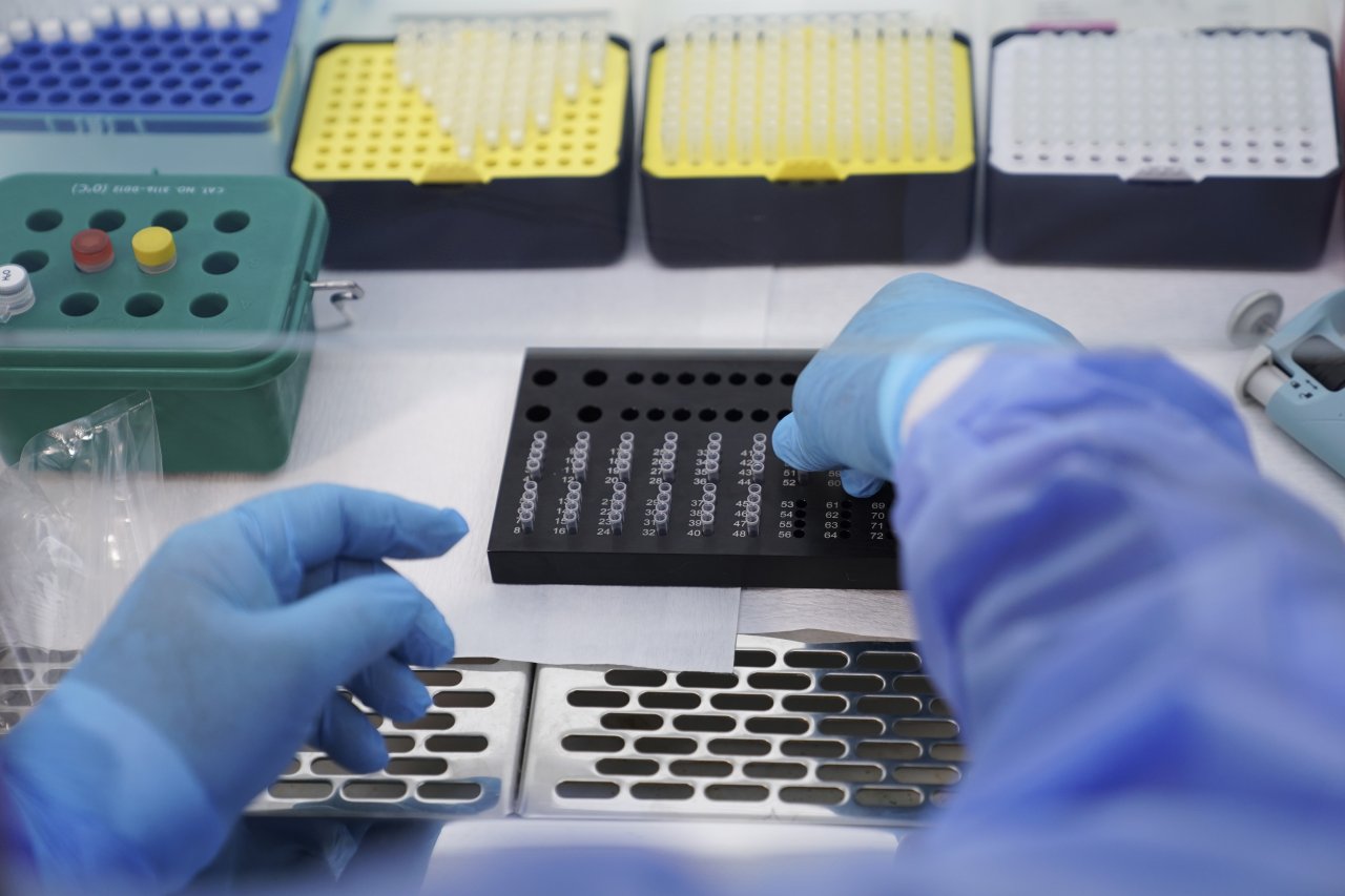 Mikrobiyologlar uyardı! Aşı sonrası antikor testlerinde güvenilirliğe dikkat edilmeli