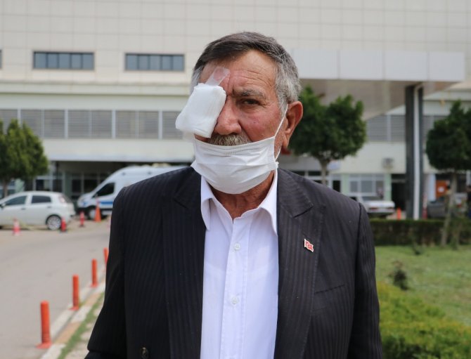 50 kuruşluk tuvalet parası kavgasında gözünü kaybetti