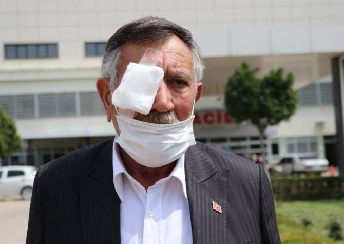 50 kuruşluk tuvalet parası kavgasında gözünü kaybetti