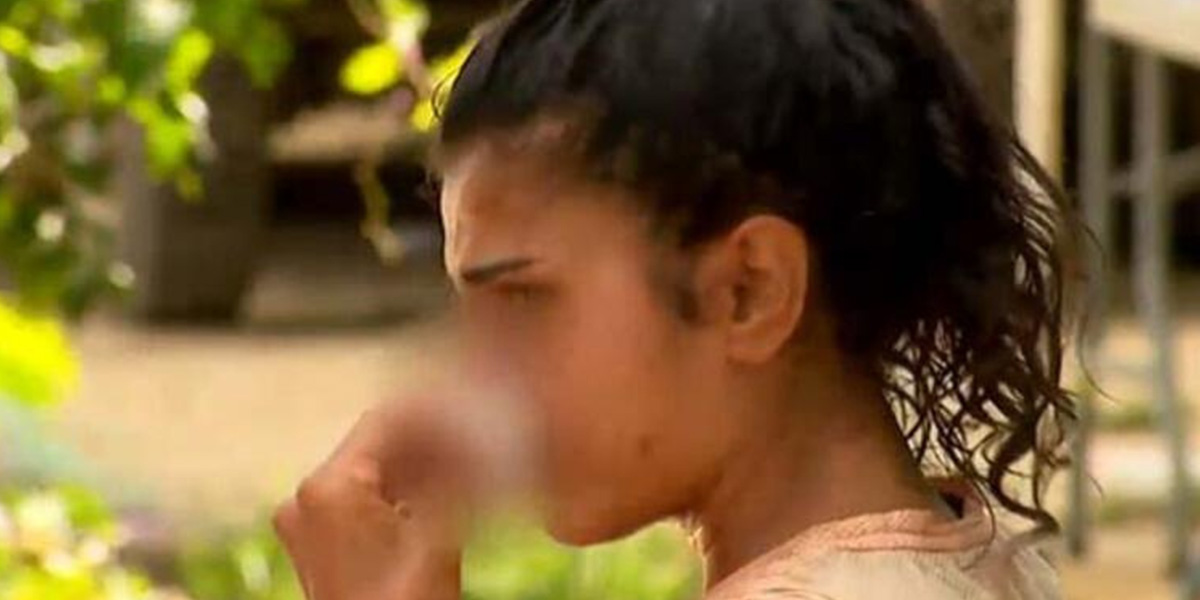 Survivor Merve kaza mı geçirdi? | Merve Aydın'a ne oldu? |Merve Aydın son durumu nasıl?