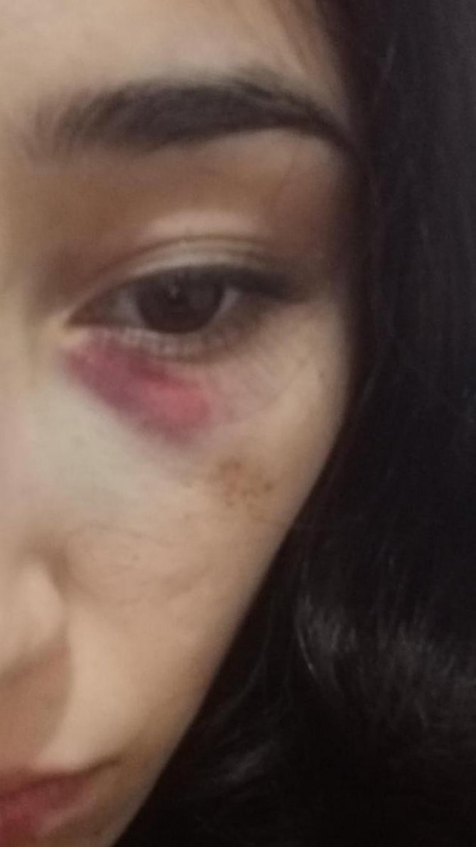 Eski sevgilisin tarafından ölüm tehditleri alan genç kız yaşamak istiyor