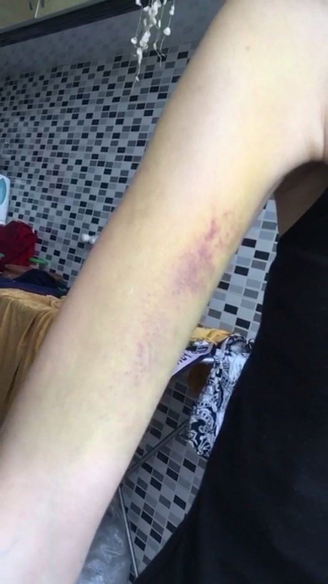 Eski sevgilisin tarafından ölüm tehditleri alan genç kız yaşamak istiyor