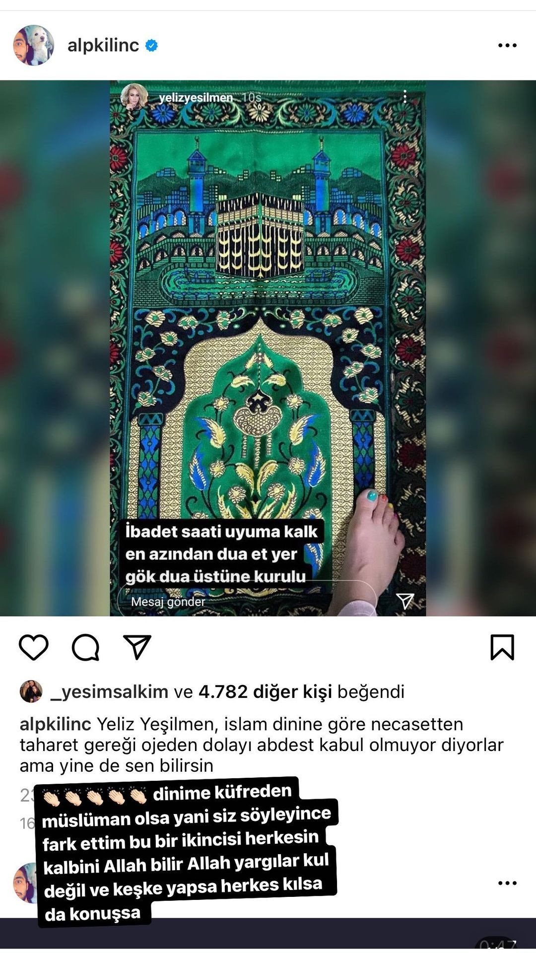 Yeliz Yeşilmen estetik operasyon geçirdi o anları paylaştı