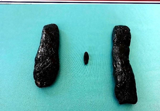 Kırıkkale'de bir şüphelinin iç çamaşırından piyasa değeri tam 300 bin lira olan uyuşturucu çıktı