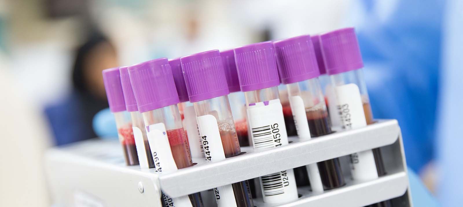 İnternetten tahlil sonucu nasıl öğrenilir? İnternetten tahlil sonuçları nasıl alınır, sorgulama nasıl yapılır 2021?