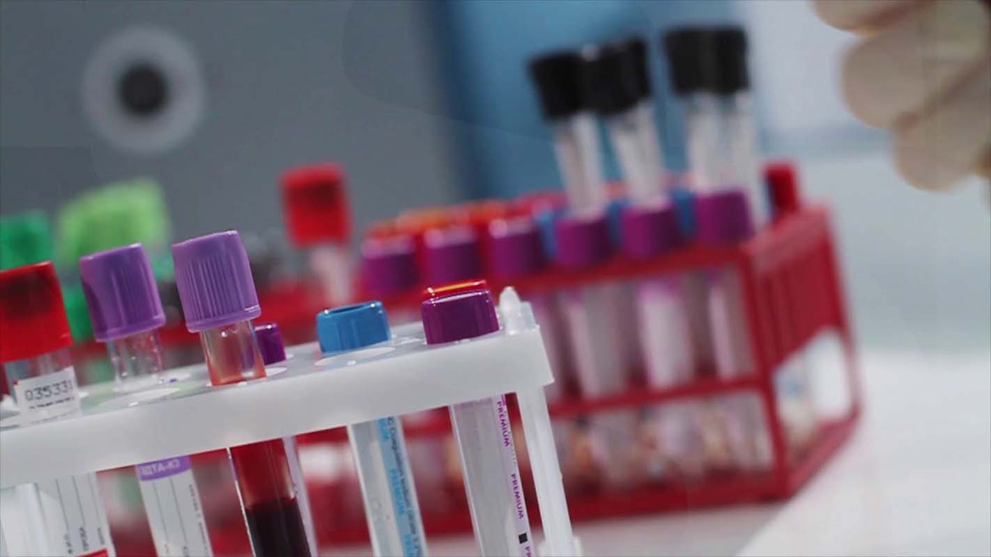 İnternetten tahlil sonucu nasıl öğrenilir? İnternetten tahlil sonuçları nasıl alınır, sorgulama nasıl yapılır 2021?