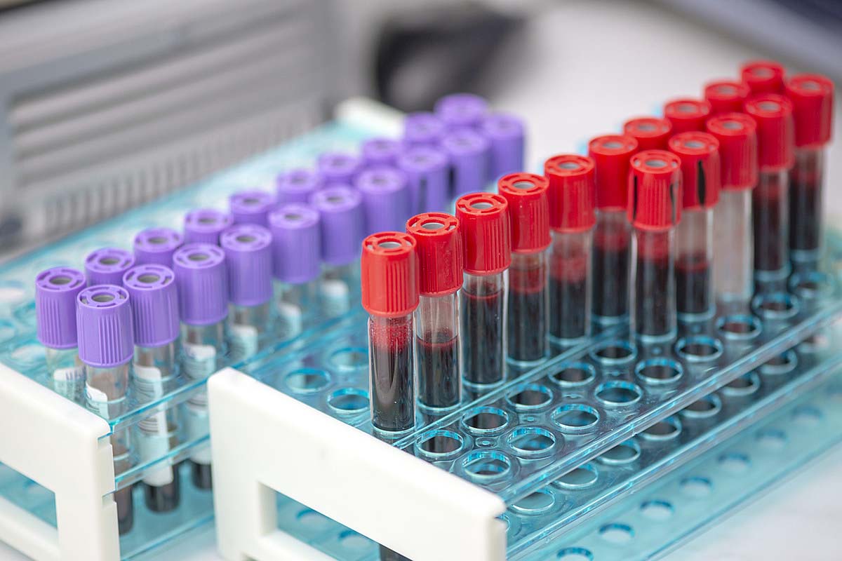 İnternetten tahlil sonucu nasıl öğrenilir? İnternetten tahlil sonuçları nasıl alınır, sorgulama nasıl yapılır 2021?