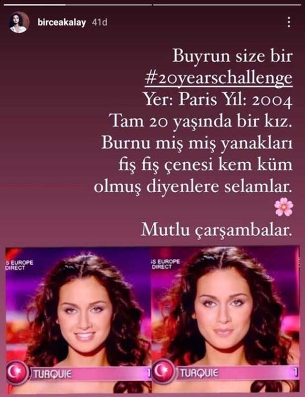 Oyuncu Birce Akalay'dan fotoğraflı estetik açıklaması!