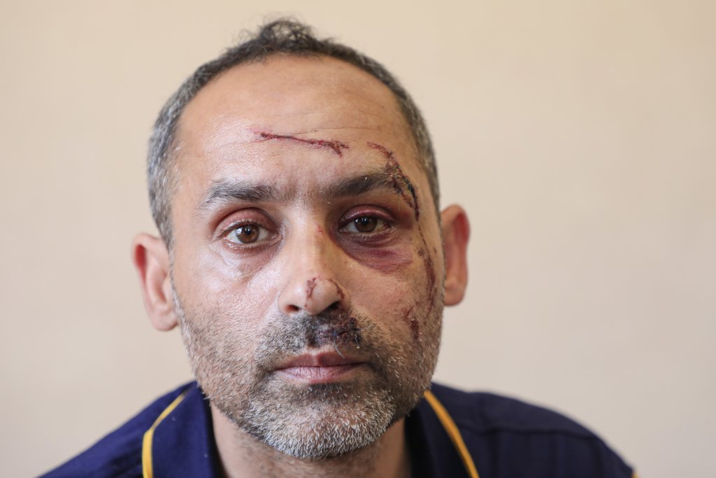 Filistinli ailelerin yürek yakan dramı! İsrail terörünün parçaladığı hayatlar