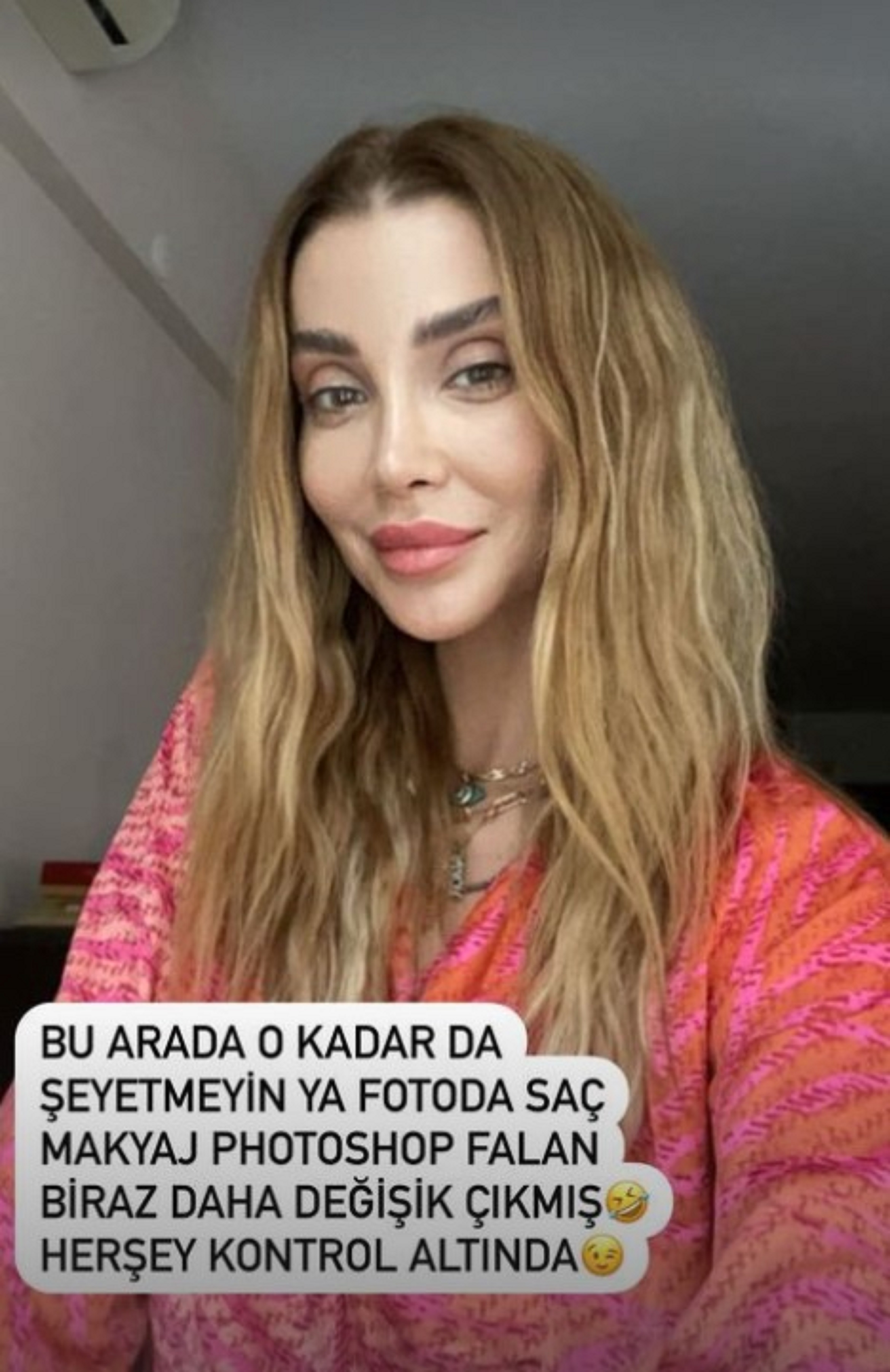 Görenler tanımakta zorlandı! Özge Ulusoy estetikli haliyle sosyal medyanın diline düştü