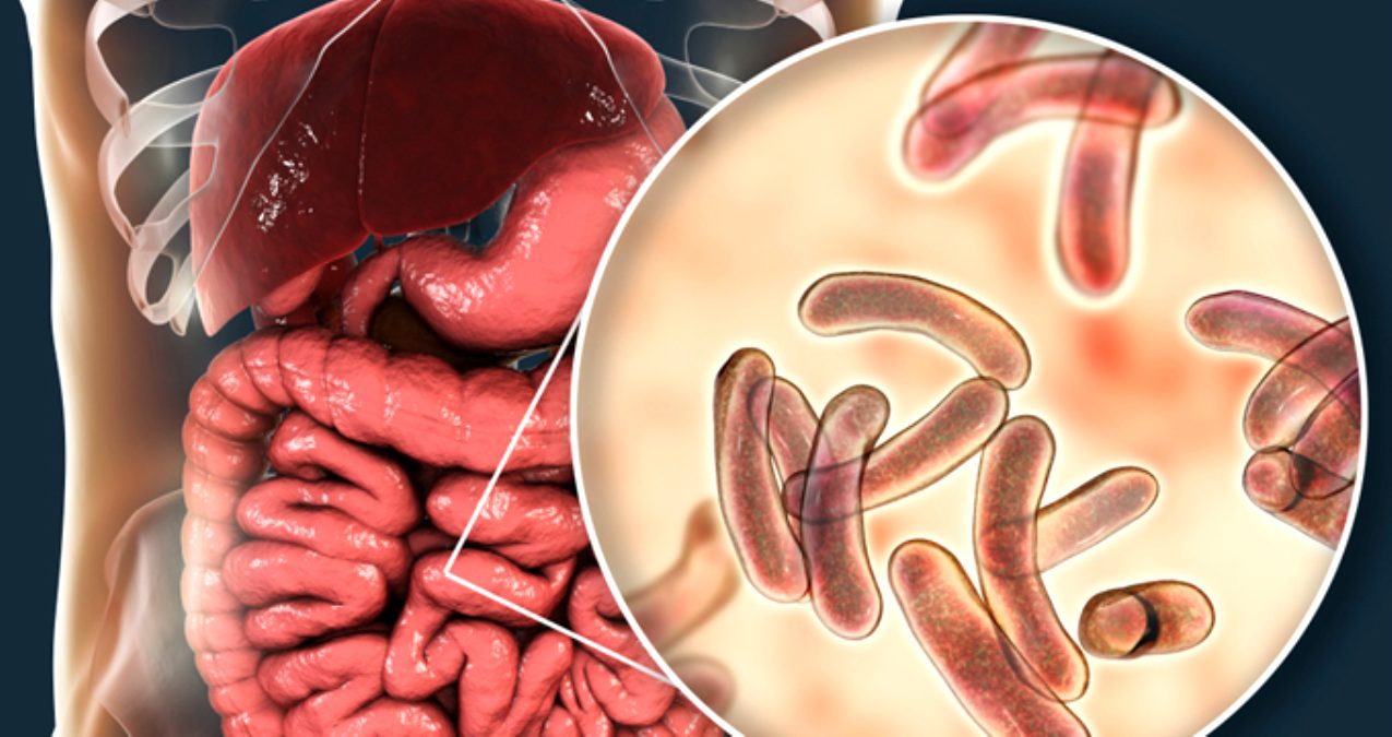 Kolera salgını yeniden dirildi! Nijerya'da ölü sayısı 37'ye çıktı... Önlem alınmalı!