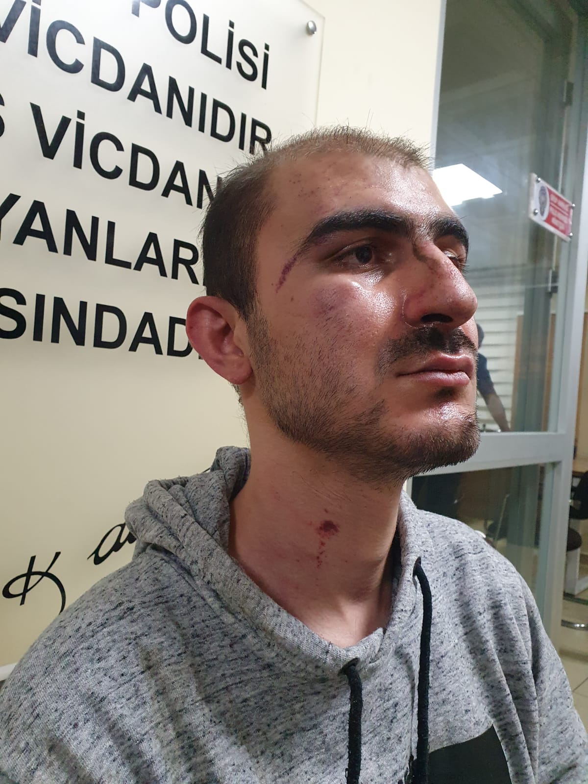 Pendik'te vicdanları yaralayan olay: Engelli genci tacizci sanıp öldüresiye dövdüler! Gerçek bambaşka çıktı