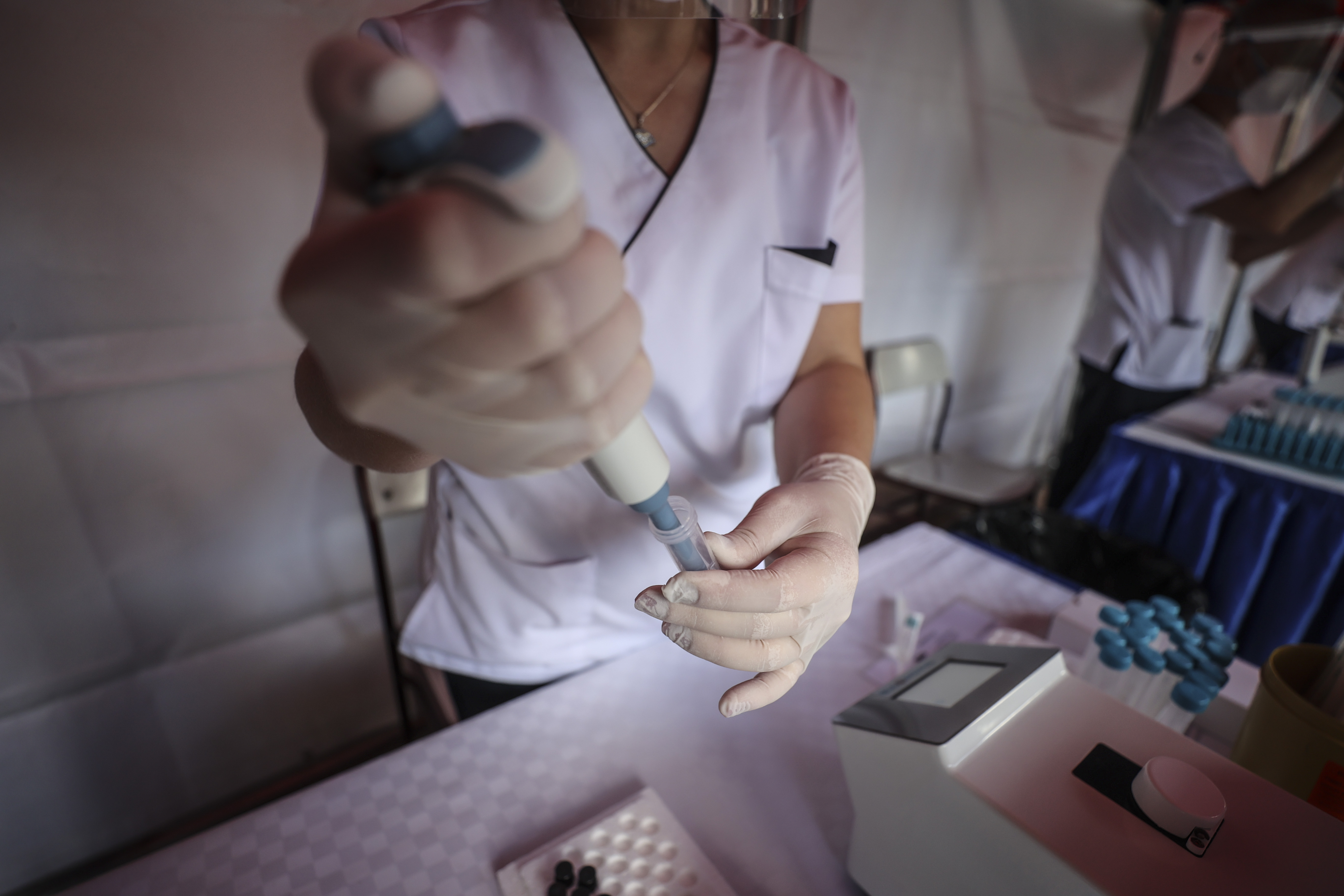 Yerli test kiti sonucu 10 saniyede sonuçlanıyor