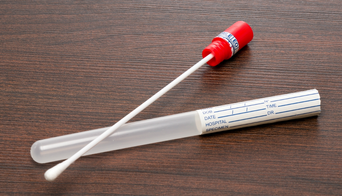 Swap izi nedir, kaç gün kalır? Swap testi nedir, nasıl yapılır? Müge Anlı’daki mehir cinayetinde alınan Swap ne demektir?