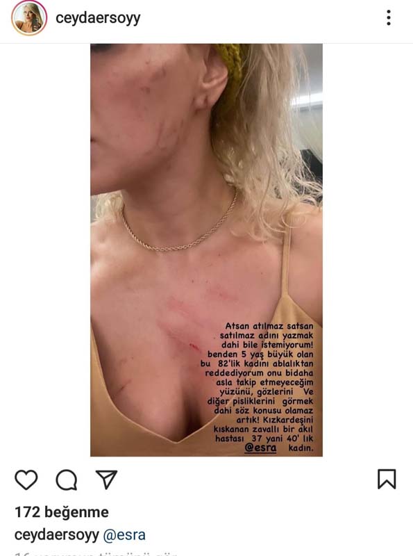 Esra - Ceyda kardeşler şaşırtmaya devam ediyor! Ablasını reddetmişti şimdi dudak dudağa!