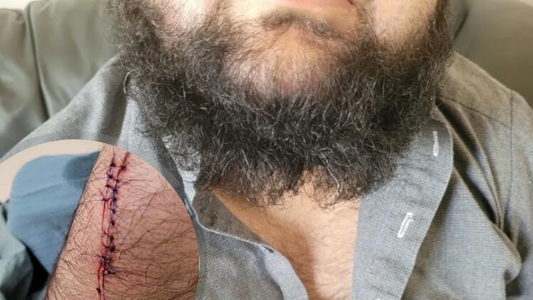 Kanadada İslamafobi tırmanıyor! Müslüman gence çirkin saldırı! Alay ettiler, bıçakladılar, sakalını kestiler...