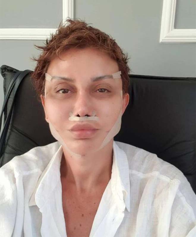 Ünlü sunucu Serap Paköz, estetik olanlar kervanına katıldı: Benim neyim eksik?