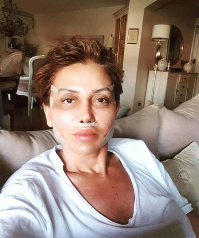 Ünlü sunucu Serap Paköz, estetik olanlar kervanına katıldı: Benim neyim eksik?