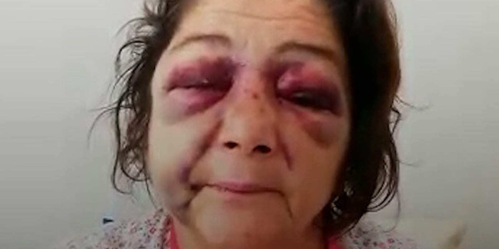 Dikkat çeken iddia! 'Park bakımsız' diyen kadın, CHP'li başkanın adamları tarafından öldüresiye dövüldü