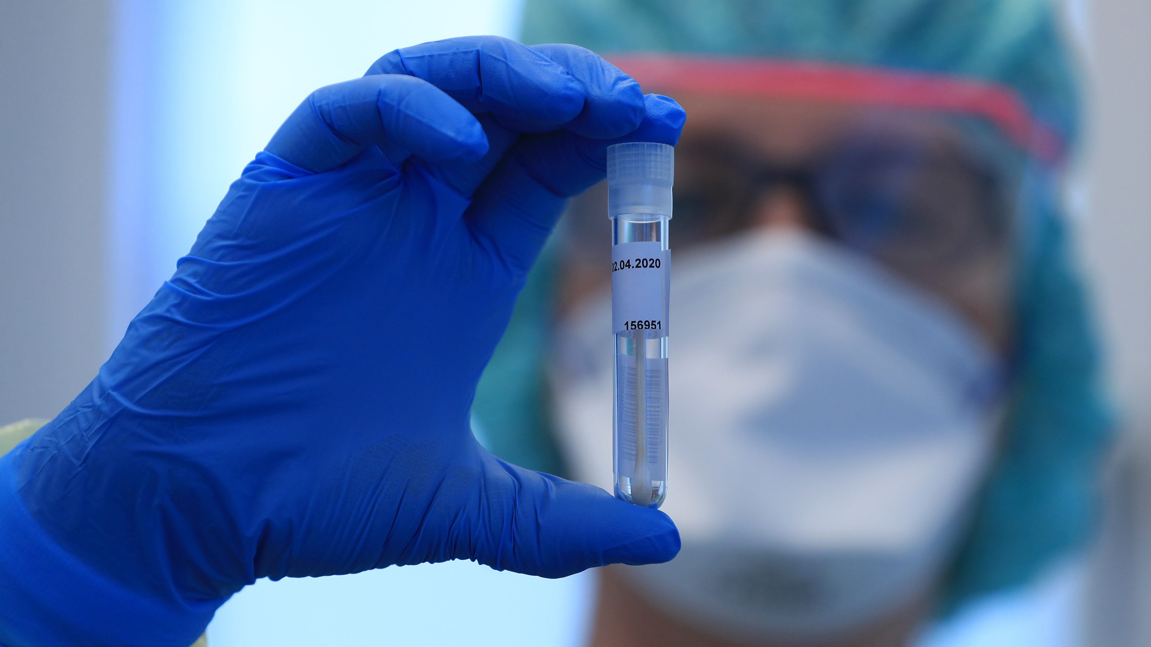 Yerli çalışmalar ulusal dergide: CoronaVac'ın Türkiye'deki üçüncü faz denemeleri ünlü tıp dergisi 'The Lancet'te yayımlandı!