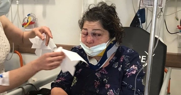 Öldüresiye darp edilen Ülfet Dikici olayında CHPli başkandan akıllara zarar savunma! Bana vurmaya çalışırken yüzünü masaya çarptı