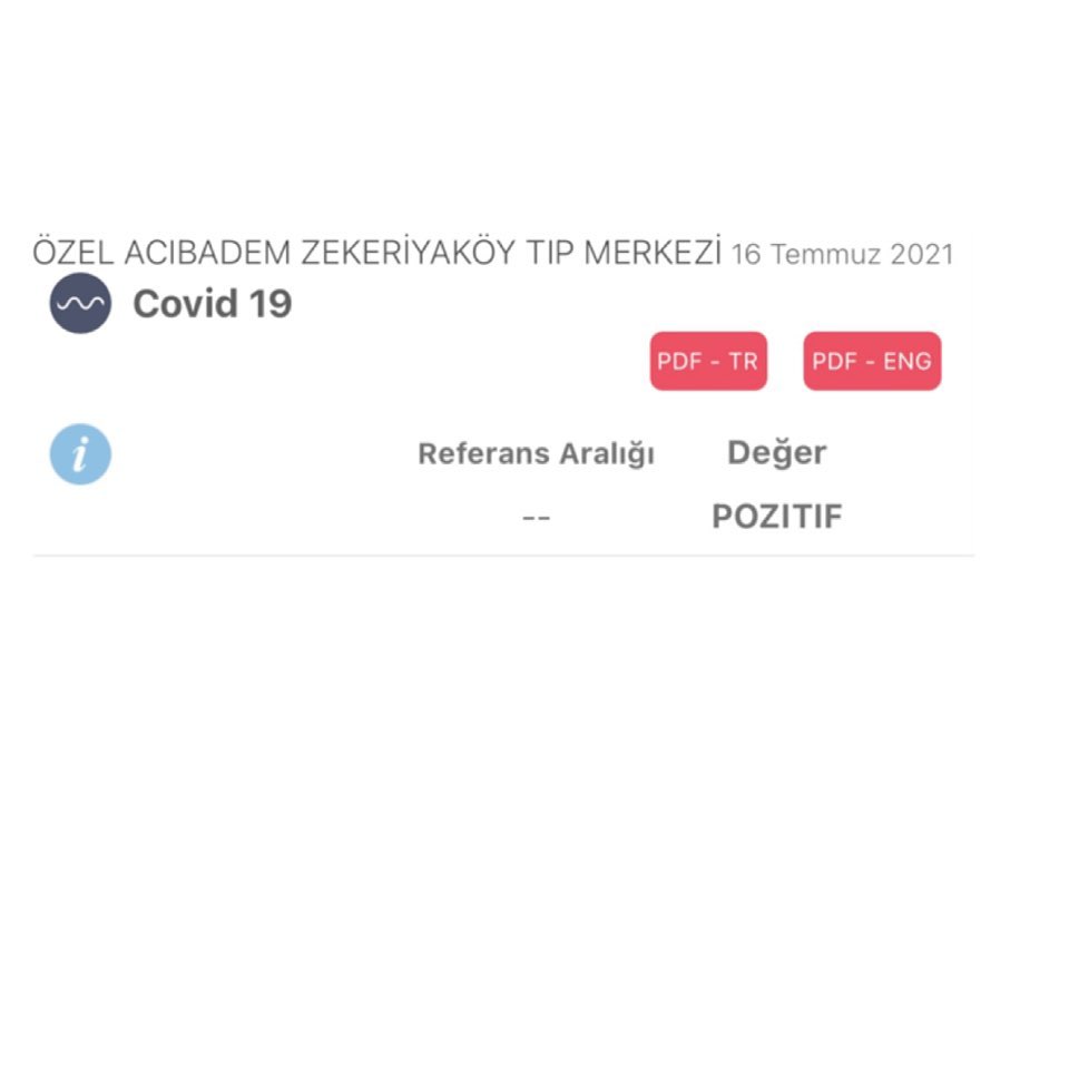 Şarkıcı Aylin Coşkun'dan üzen haber geldi: Dikkatsizin biri yaktı hepimizi