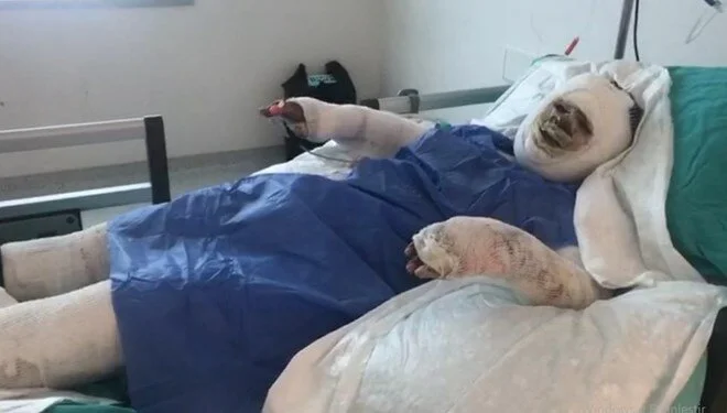 Böyle vahşet görülmedi! Kayınvalidesini benzin döküp ateşe verdi, karşısına geçip yanmasını izledi