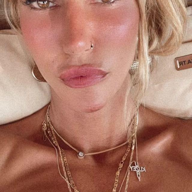 Amuda kalktı olanlar oldu! Çağla Şıkel başına gelen talihsiz kazayı takipçileriyle paylaştı!