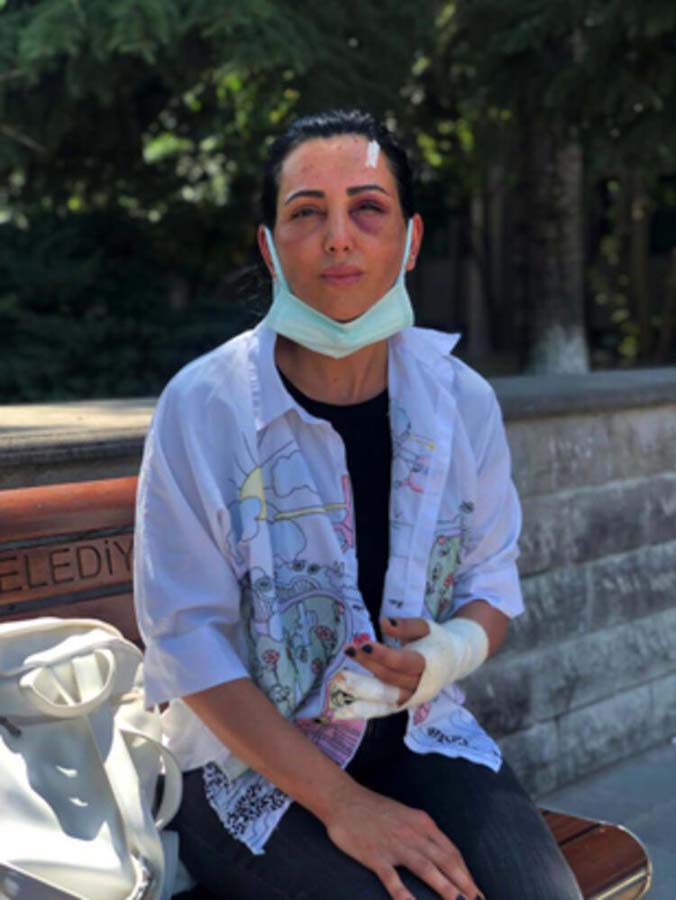 Ankara'da kadına şiddet: Taksiyi durdurup eski sevgilisini 20 dakika boyunca darp edip evinin önüne attı!