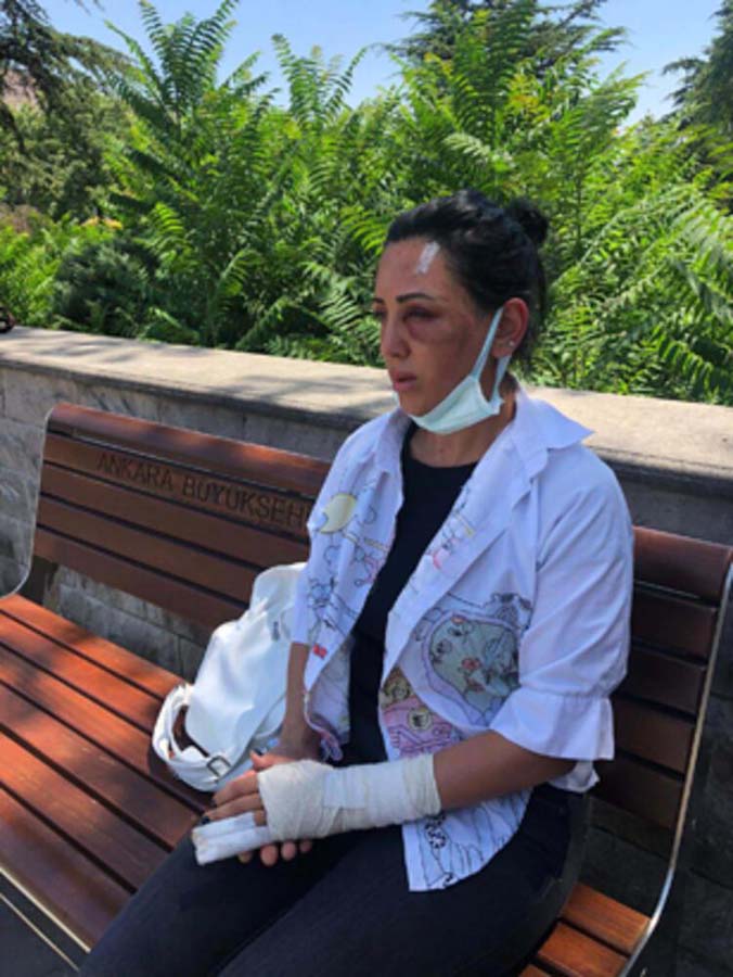 Ankara'da kadına şiddet: Taksiyi durdurup eski sevgilisini 20 dakika boyunca darp edip evinin önüne attı!