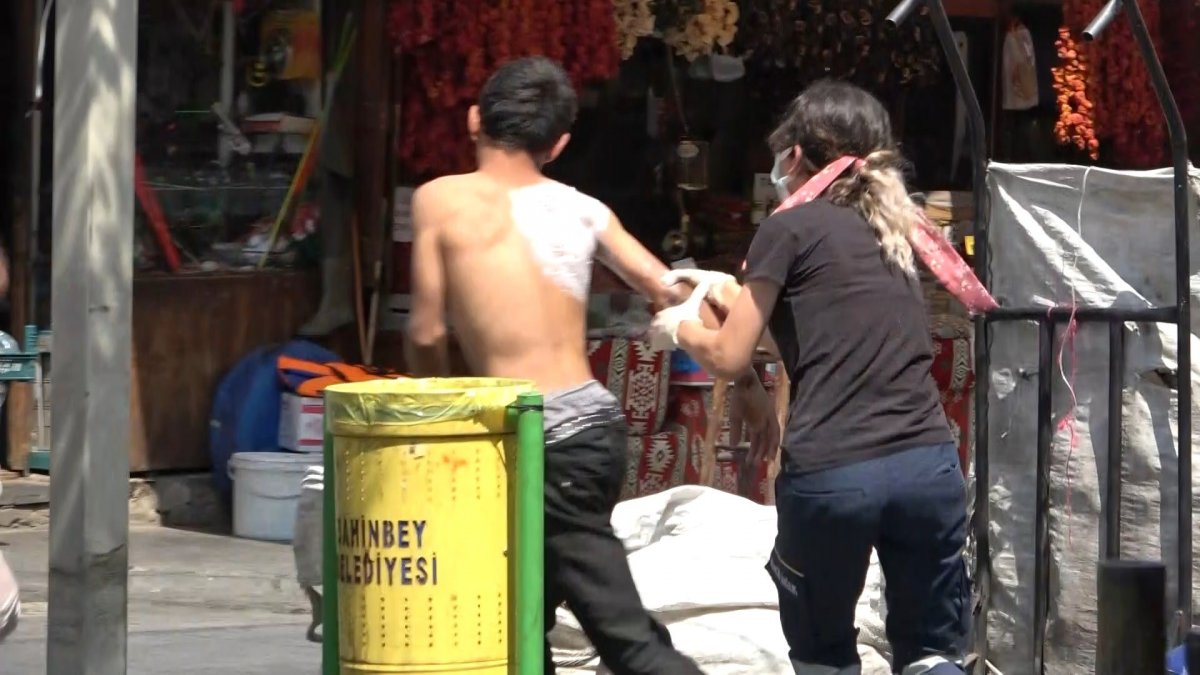 Karton toplamak için çöp konteynerine giren çocuğu fark etmedi, üzerine kaynar çay döktü!