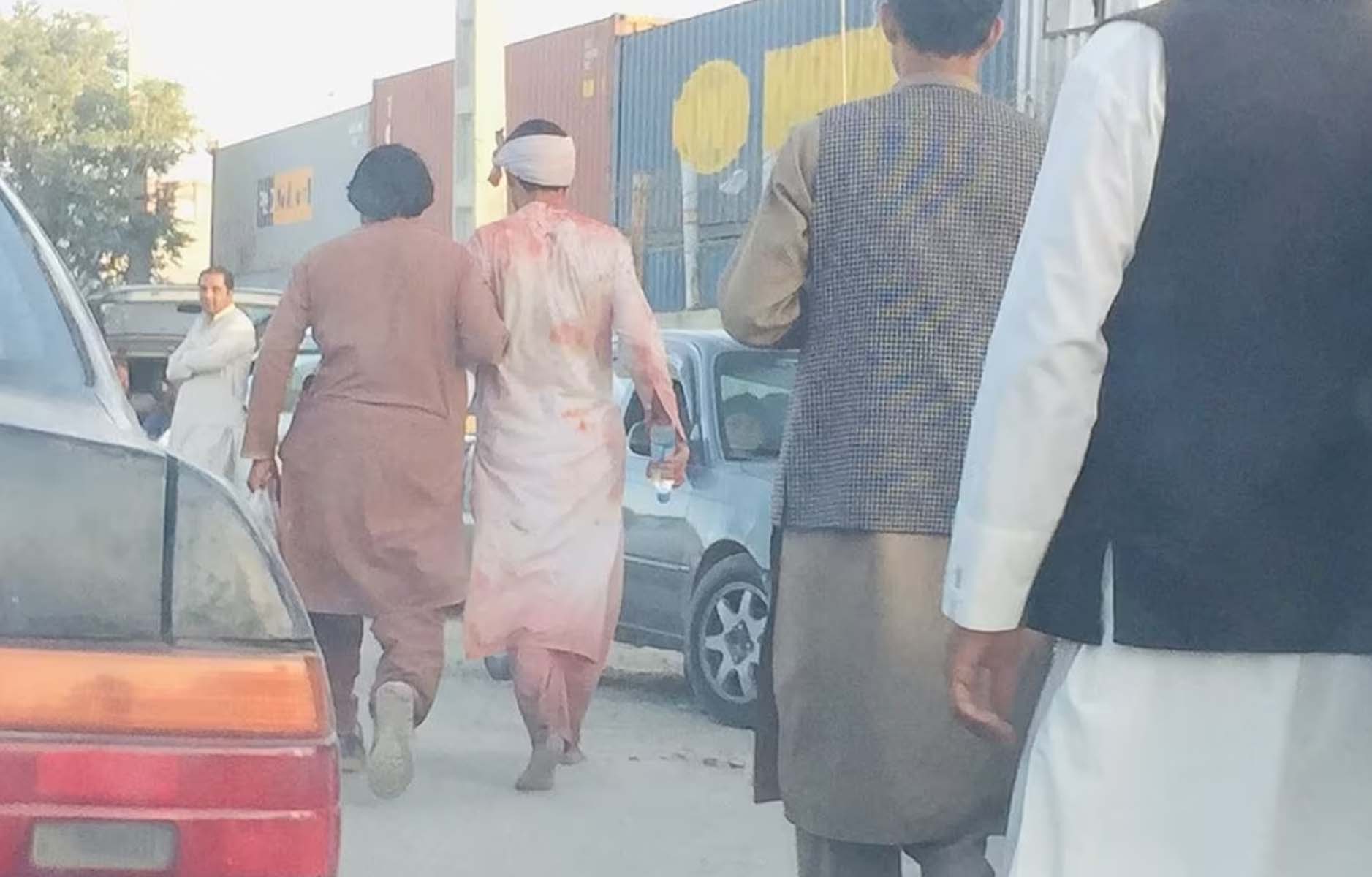 Son dakika | Kabil Havalimanı dışında patlama meydana geldi: 13 kişi hayatını kaybetti, yaralılar var