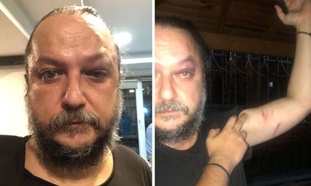 Güvenç Dağüstün’e saldıranlar serbest bırakıldı!