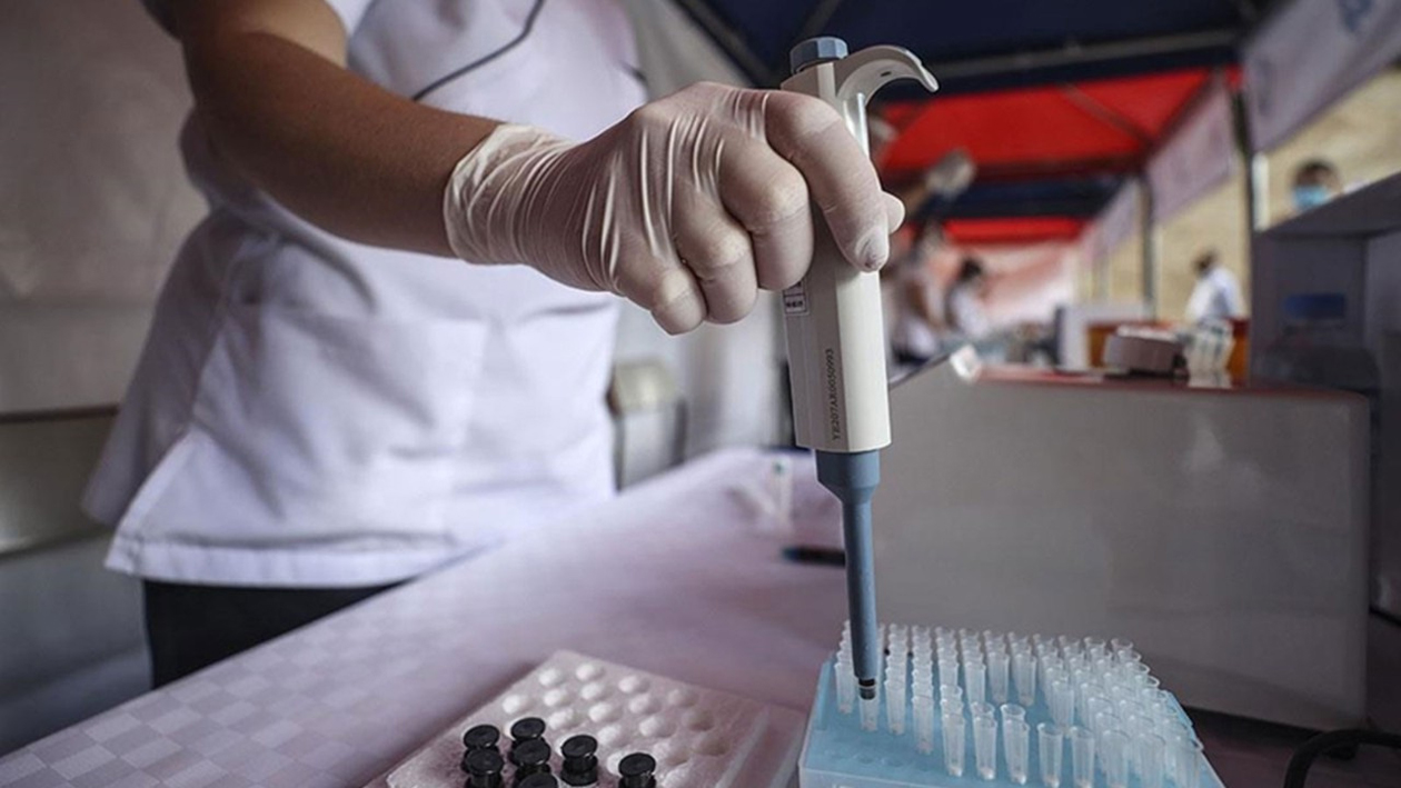 10 saniyede sonuç gösteren yerli test kiti üretildi! Yurtdışından yoğun talep var!