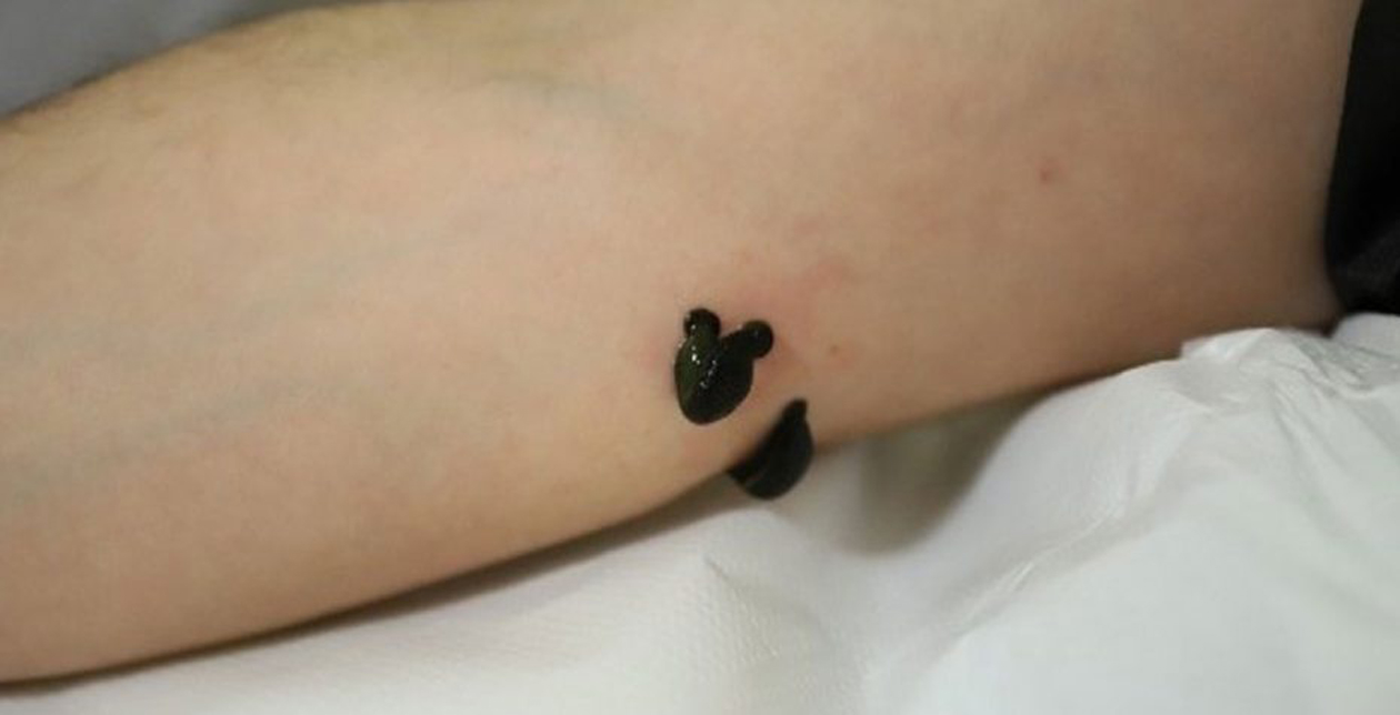 Doktorlarda ne yapacağını şaşırdı: Aşı olan vatandaştan hastane bahçesinde tarihe geçecek hareket! Aşıyı kolundan atmak için bakın ne yaptı!