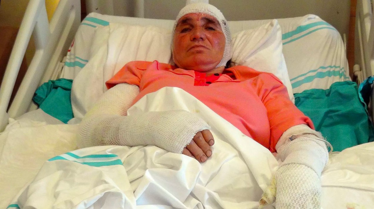 Az kalsın yanarak can verecekti: Tandıra düştü, kendi çabalarıyla kurtuldu!